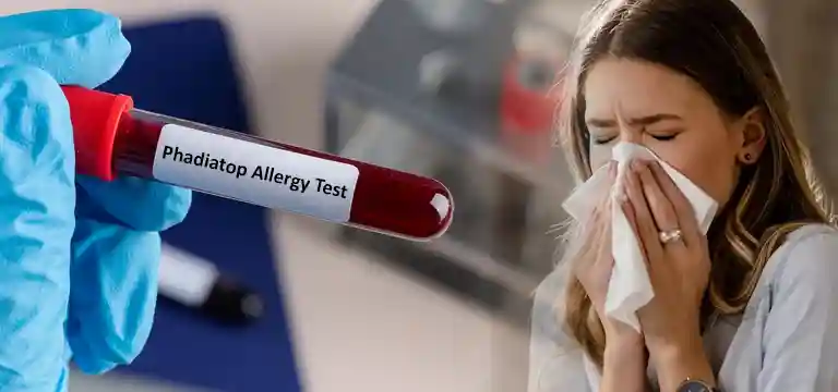 Phadiatop Allergy Test: Detecting common allergens for accurate diagnosis